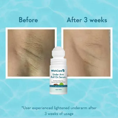 Underarm skin shows lightening after 3 weeks of using roll-on serum.