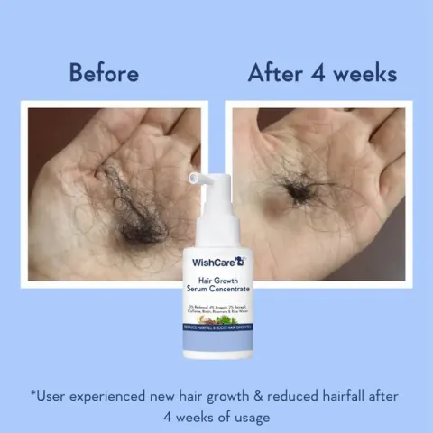 Two hands showing less hair loss after 4 weeks, with a hair growth serum bottle below.