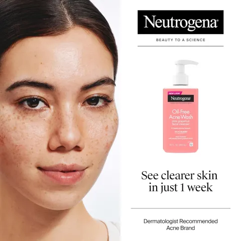 Woman with freckles and clear skin next to a Neutrogena acne face wash bottle on a white background.