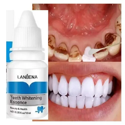 Lanbena Teeth Whitening Essence bottle with before and after images of stained and white teeth.