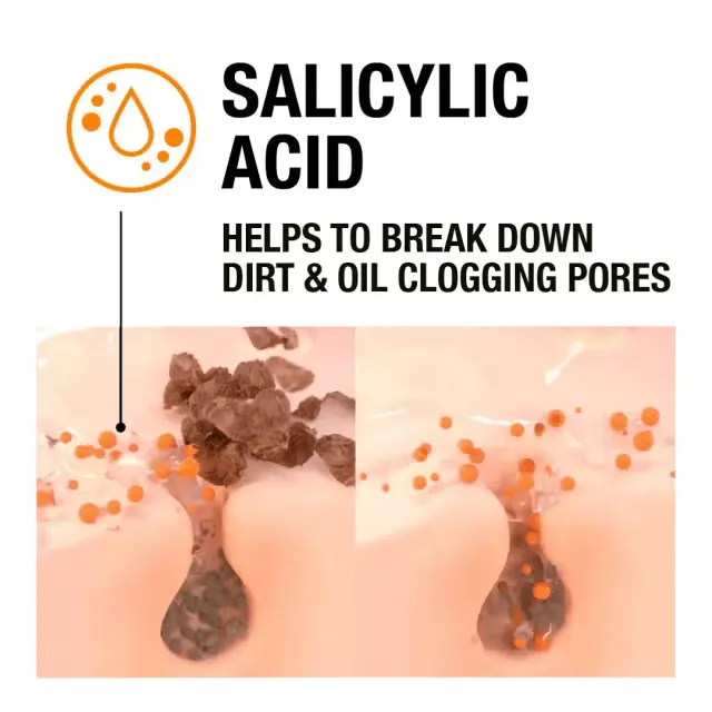 Two diagrams show salicylic acid breaking down dirt and oil in clogged skin pores.