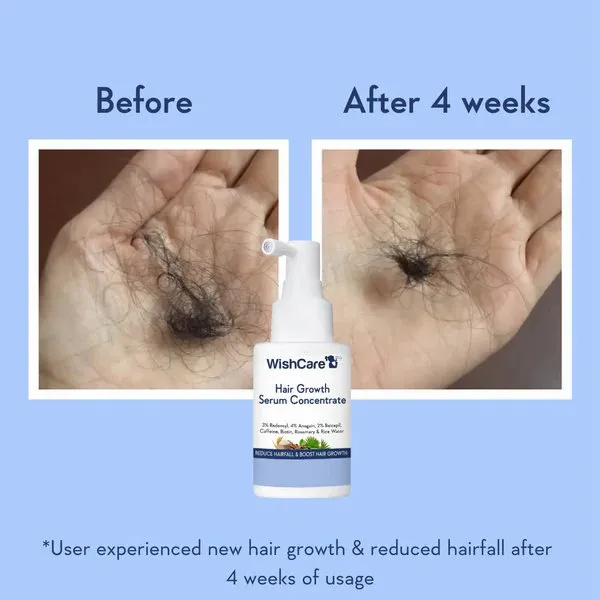 Two hands showing less hair loss after 4 weeks, with a hair growth serum bottle below.